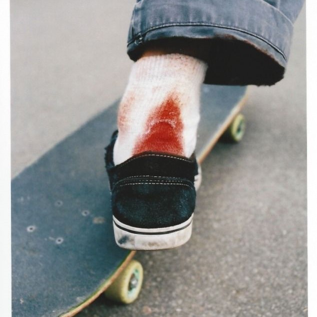how to get blood out of shoes