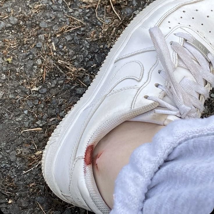 how to get blood out of shoes