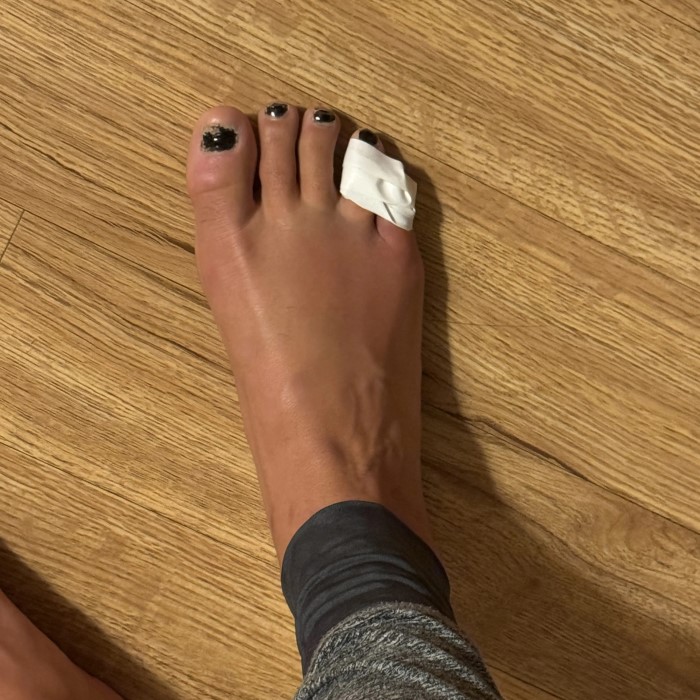 my pinky toe hurts when i wear shoes
